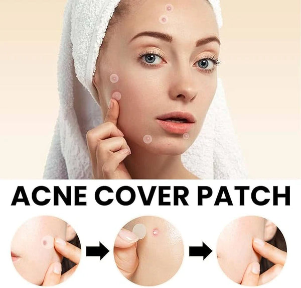 Acne Cover Patches